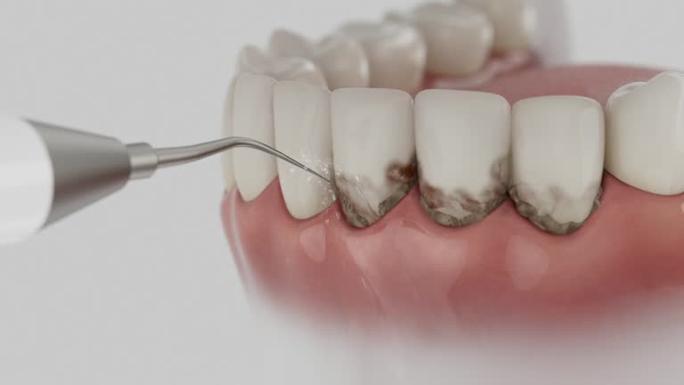 Trusted Dental Crowns And Bridges service in Wellington, TX - Dentist Open Now